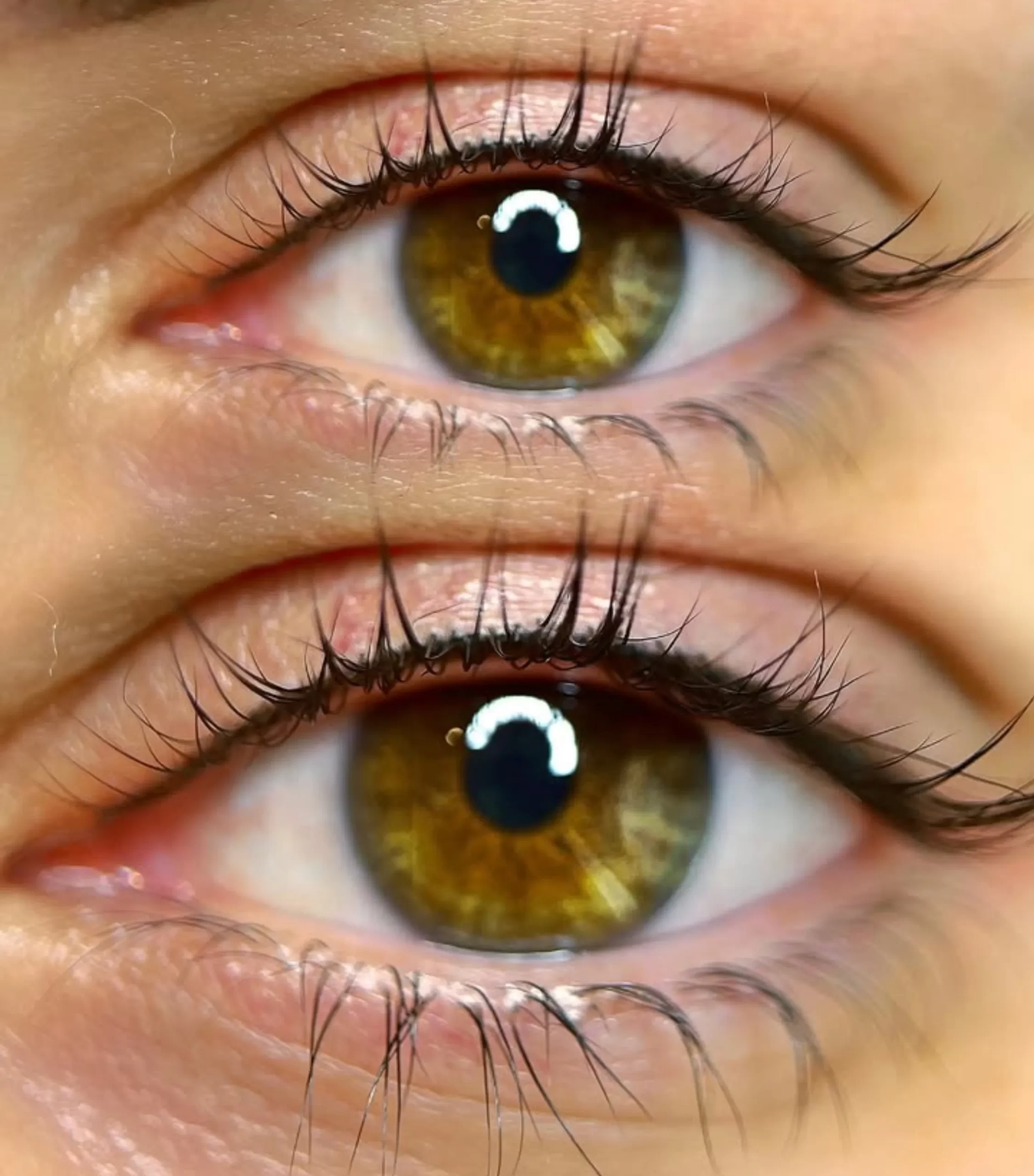 eyeliner tattoo complications