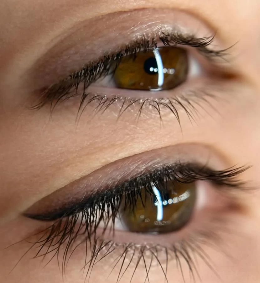 Why is my lash line tattoo gone wrong?