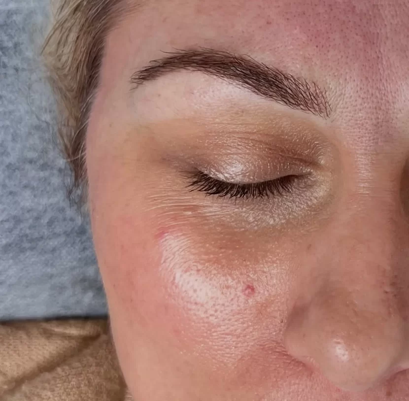 What Are the Warning Signs of Poor Microblading?