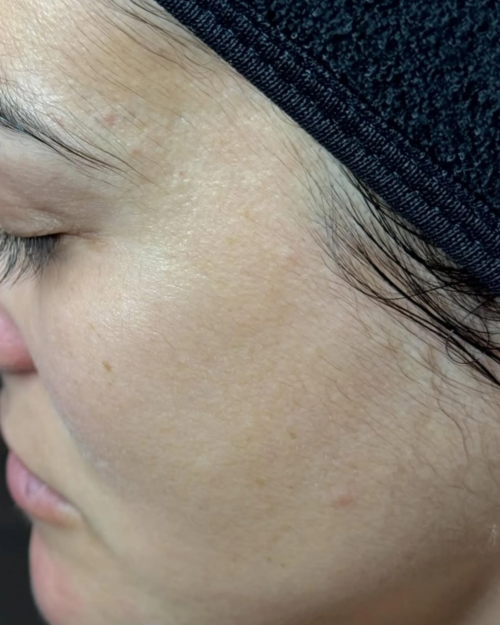 barrier repair for clear skin