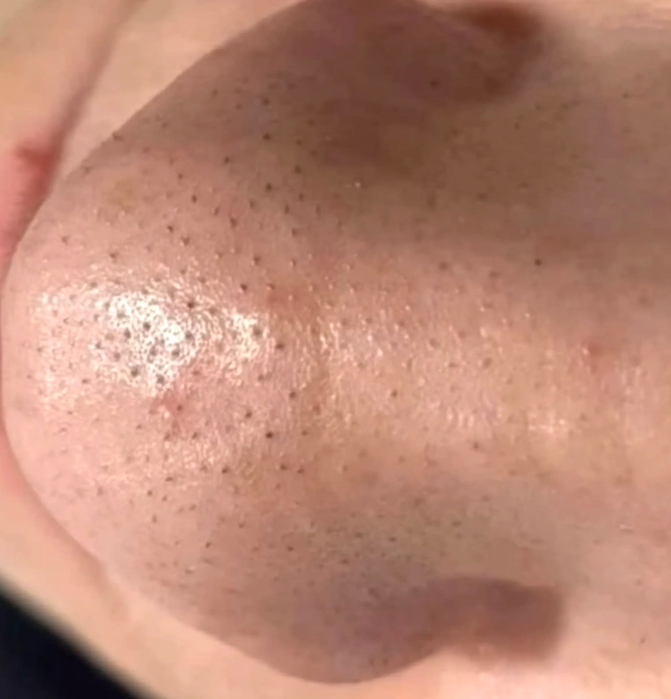 professional treatments for clear skin